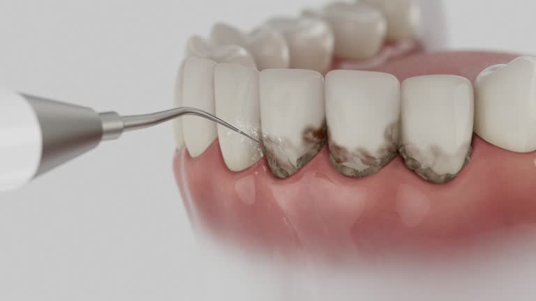 Trusted Invisalign Clear Aligners service in South Hill, VA - Dentist Open Now